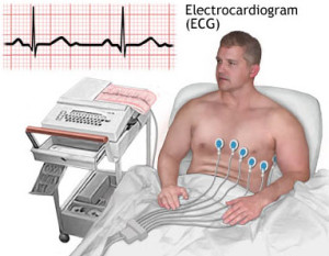 ecg